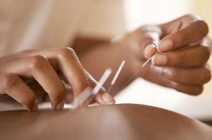 Acupuncturist inserting needles into a patient's shoulder. Light skin tone, white coat, neutral background.