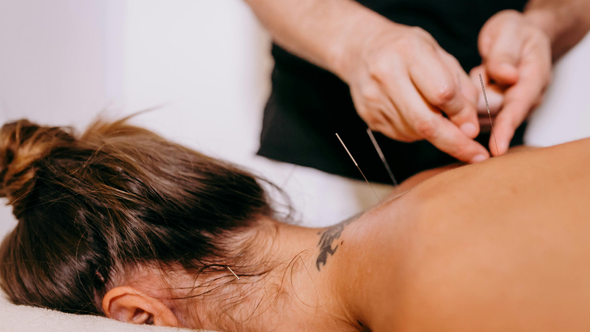 Acupuncturist inserting needles into a patient's back.