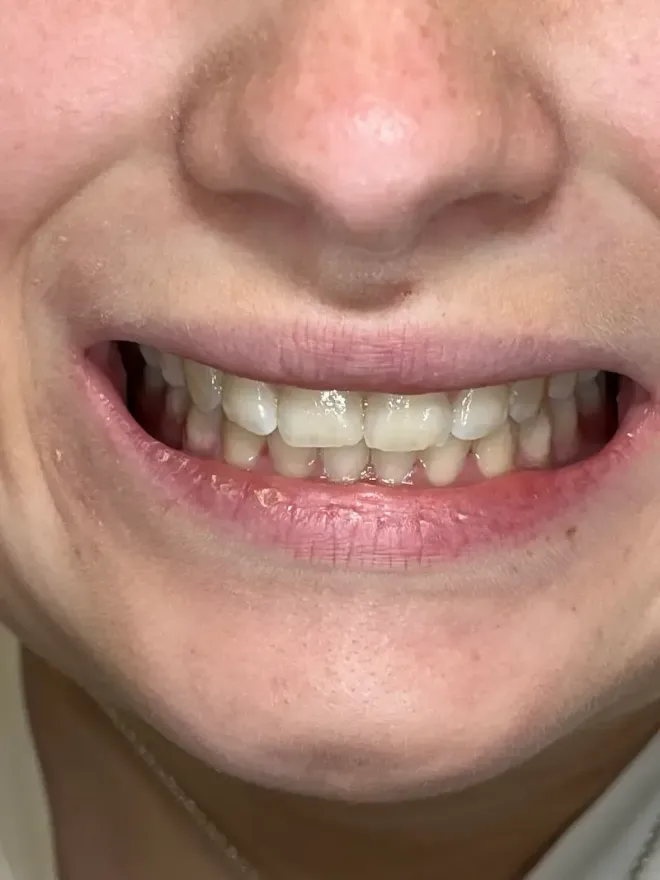 Close-up of a person's mouth with a slight smile, showing straight teeth and pink lips.