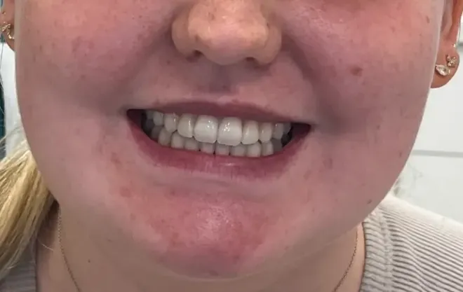 Woman smiling, showing teeth, with reddish skin and blonde hair.