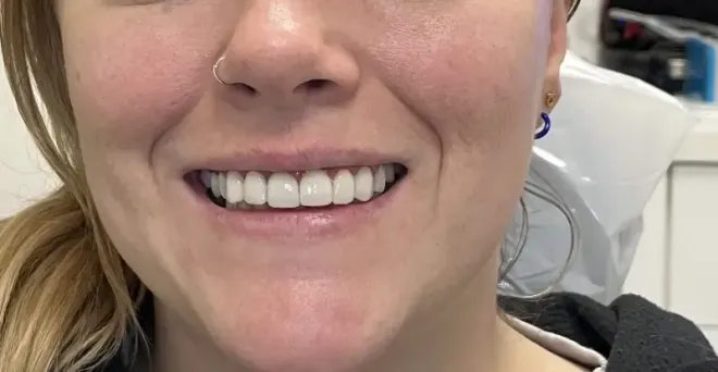 Woman smiling, showing white teeth, wearing a nose ring and earrings.