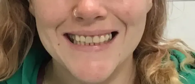 Person smiling, showing teeth. Nose ring visible. Curly hair and green shirt.