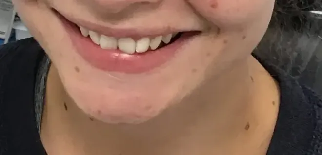 Close-up of a person's smiling mouth. The person has fair skin, light pink lips, and white teeth.