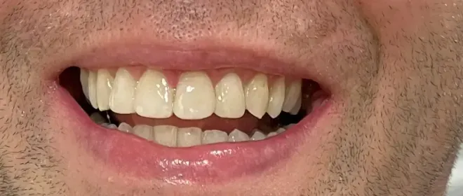 Close-up of a smiling mouth with clean, white teeth. The lips are pink and slightly glossy.