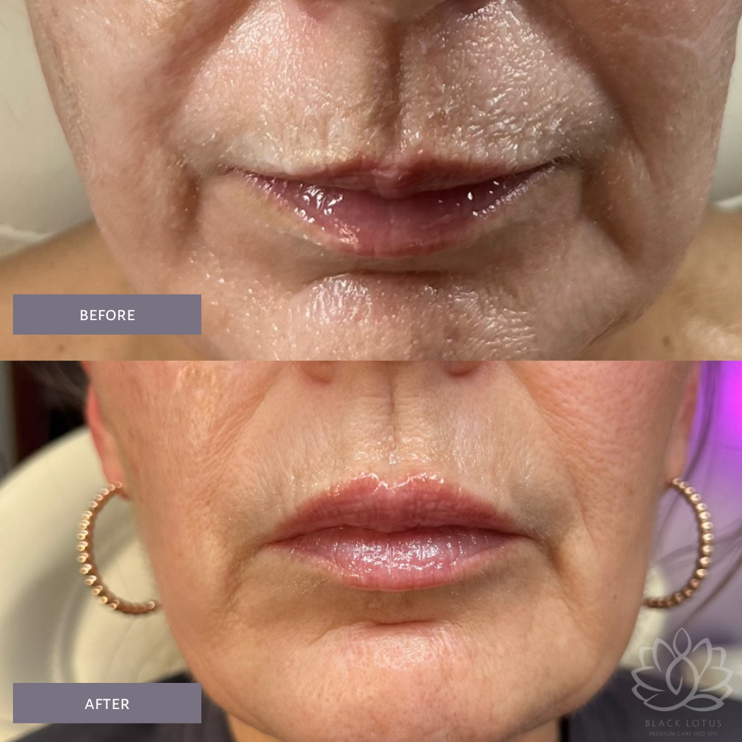 A before and after photo of a woman 's face.