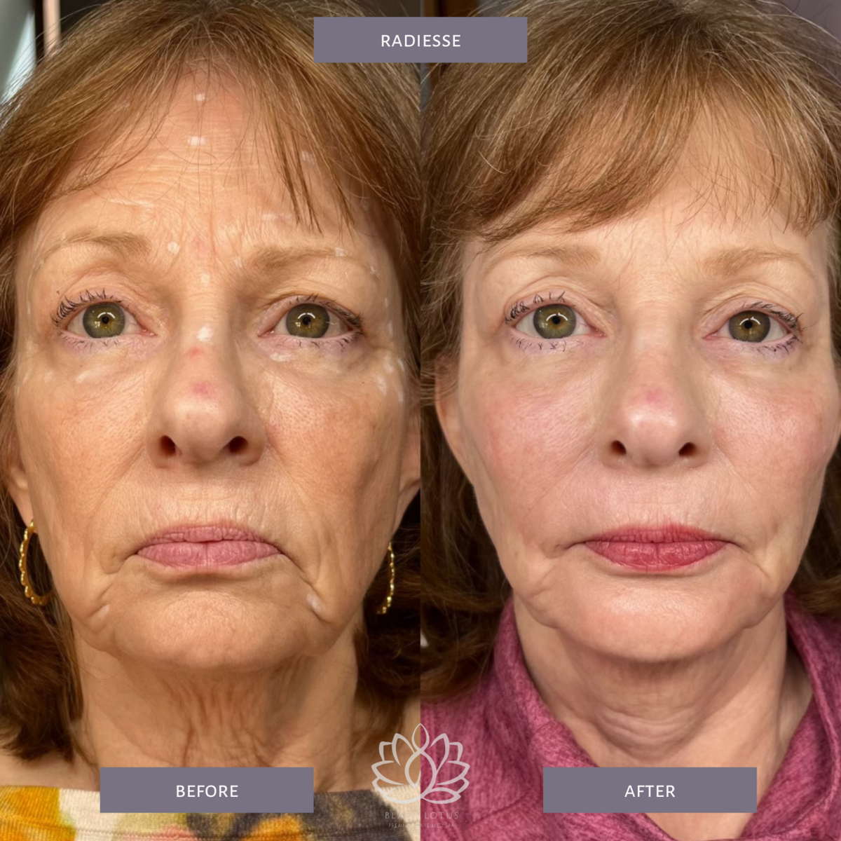 A before and after photo of a woman 's face.