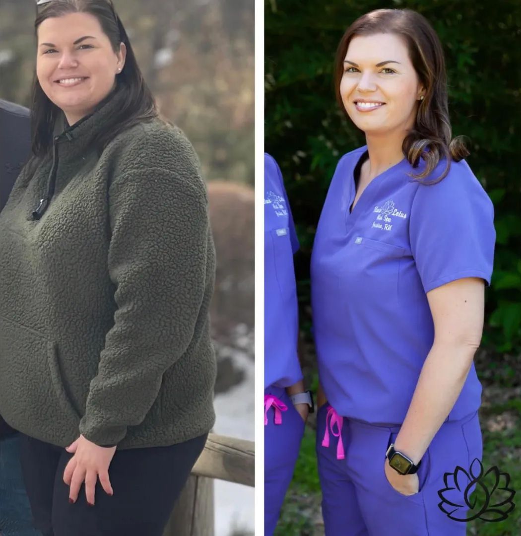 A before and after photo of a woman in scrubs