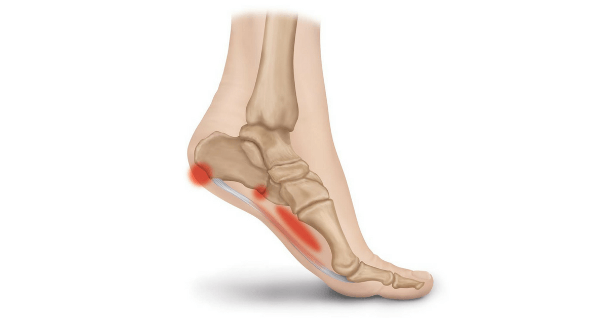 Ankle Replacement Surgery | Foot & Ankle Pain Specialists