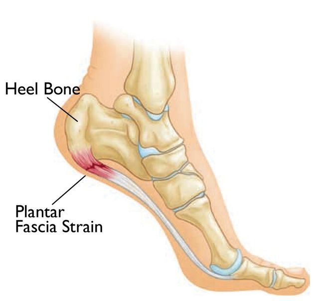 Ankle Sprain or Ligament Injury - Bunbury Foot & Ankle Surgeon