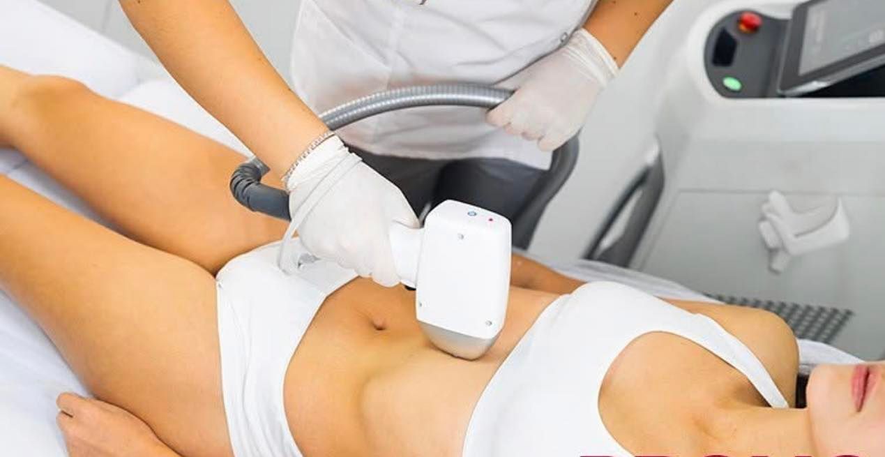 Una donna si sta sottoponendo a un trattamento laser sullo stomaco.