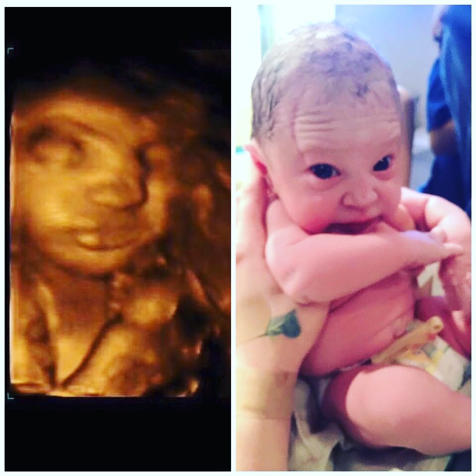 An ultrasound of a baby and a picture of a baby sleeping