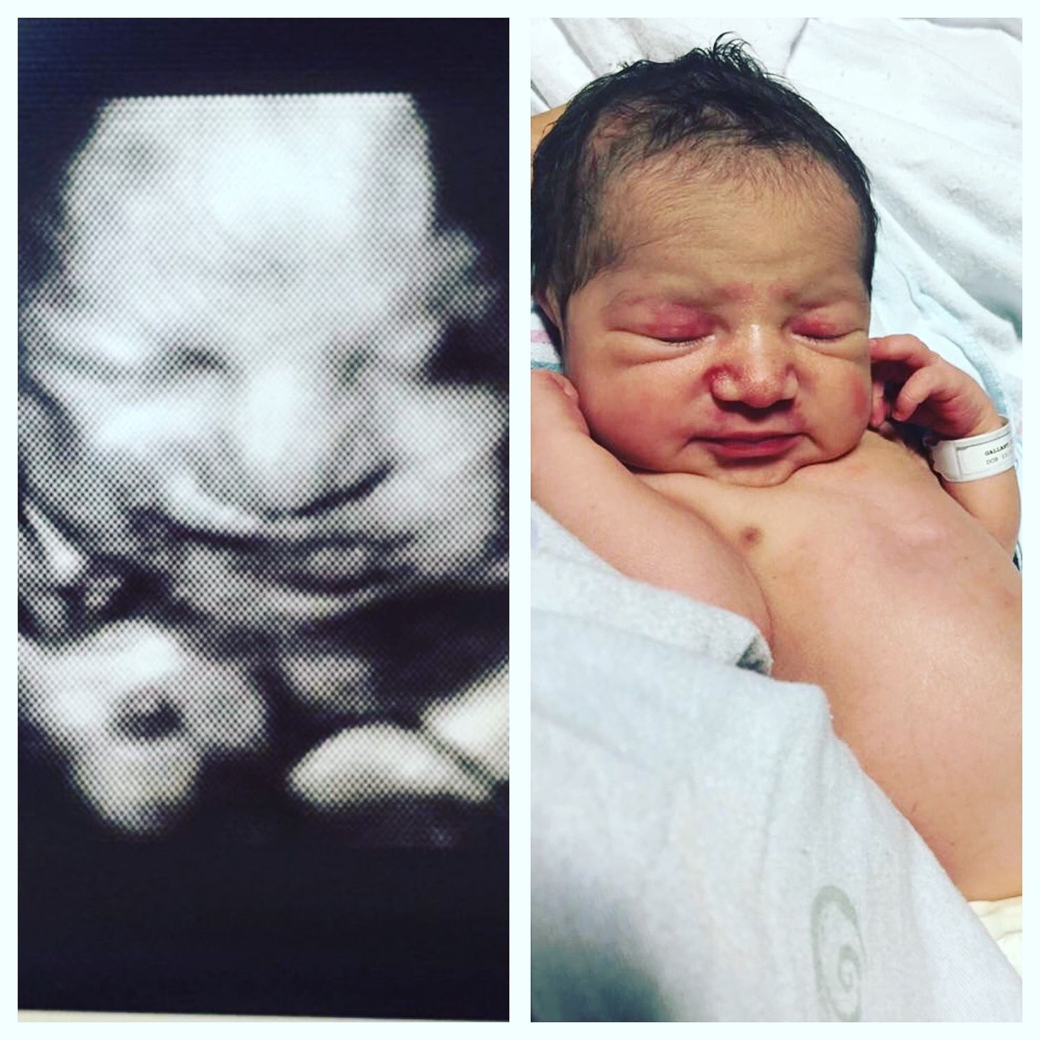 An ultrasound of a baby and a picture of a baby sleeping