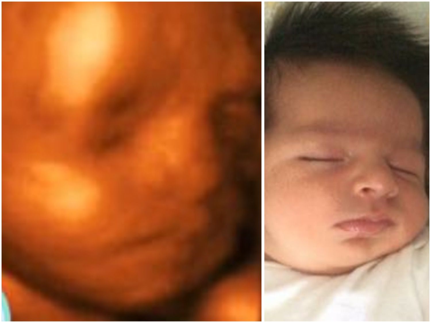 An ultrasound of a baby and a picture of a baby sleeping