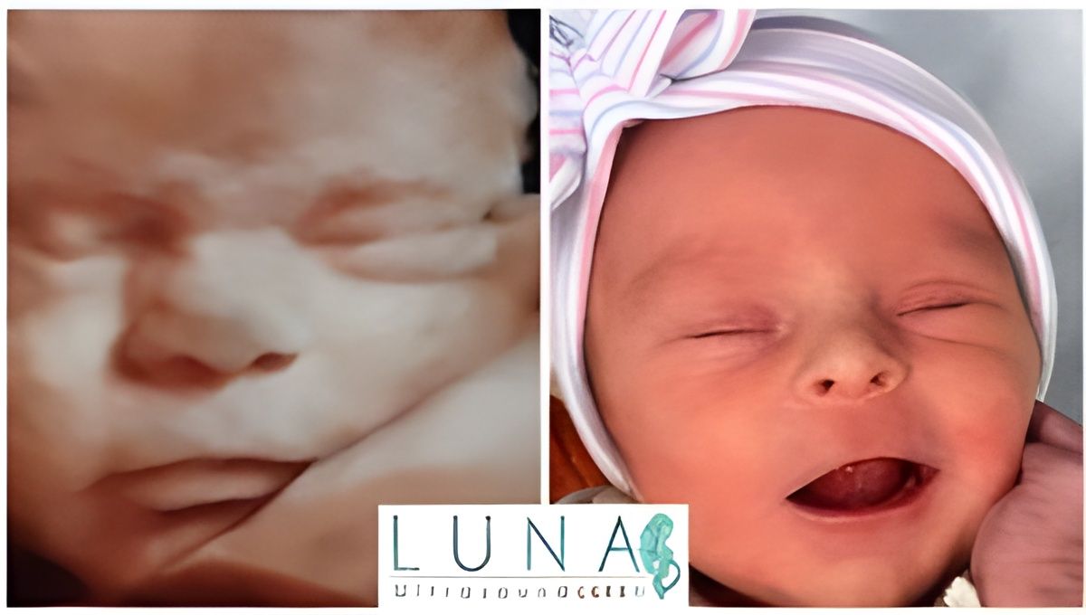 An ultrasound of a baby and a picture of a baby sleeping