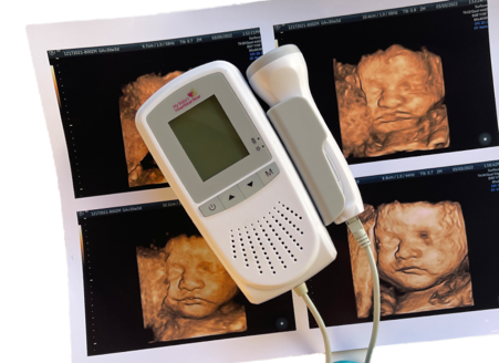 A baby monitor is sitting on top of an ultrasound of a baby 's face