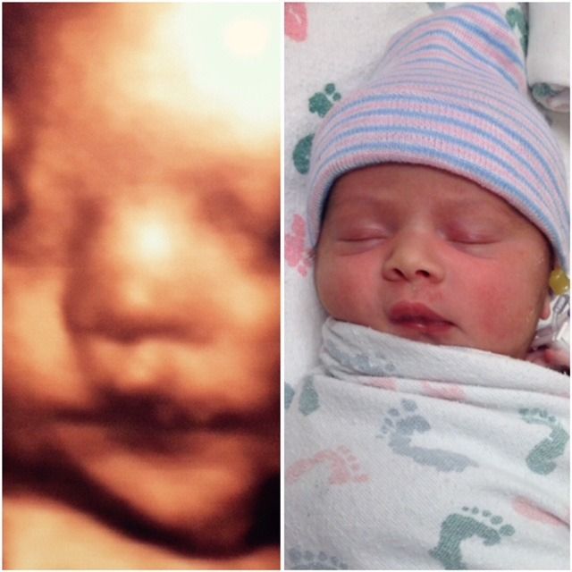 Side-by-side: 3D ultrasound of a baby's face next to a newborn baby sleeping in a hat and blanket.