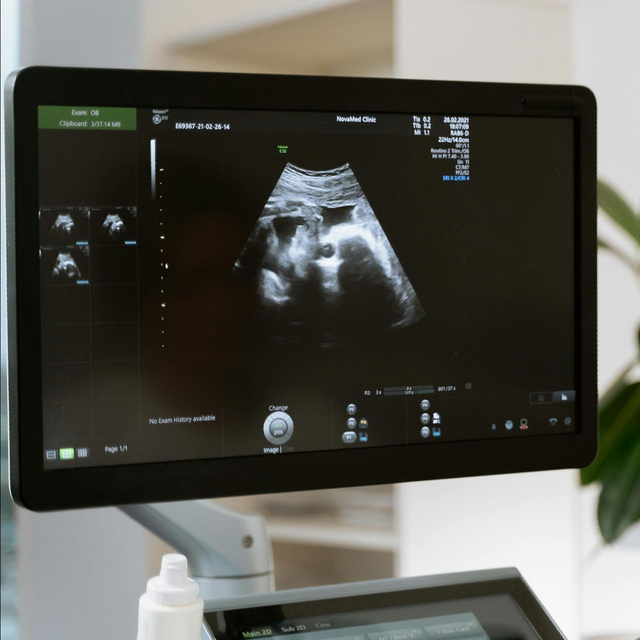 A computer monitor shows an ultrasound of a baby