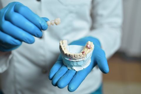 Female Patient Happily Smiling | Aberdeen, SD | Northeastern Dental Center