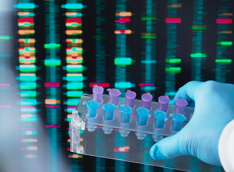 A person is holding a tray of test tubes in front of a screen.