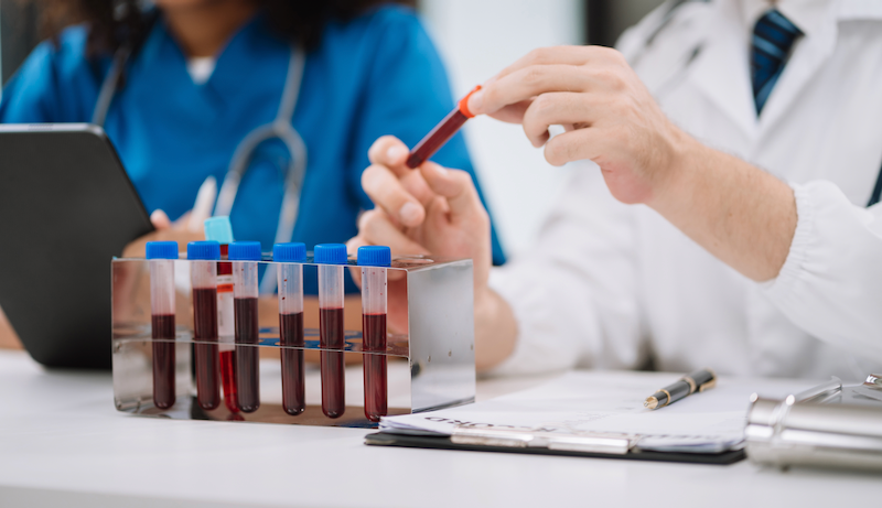 Women Analysing Blood Samples