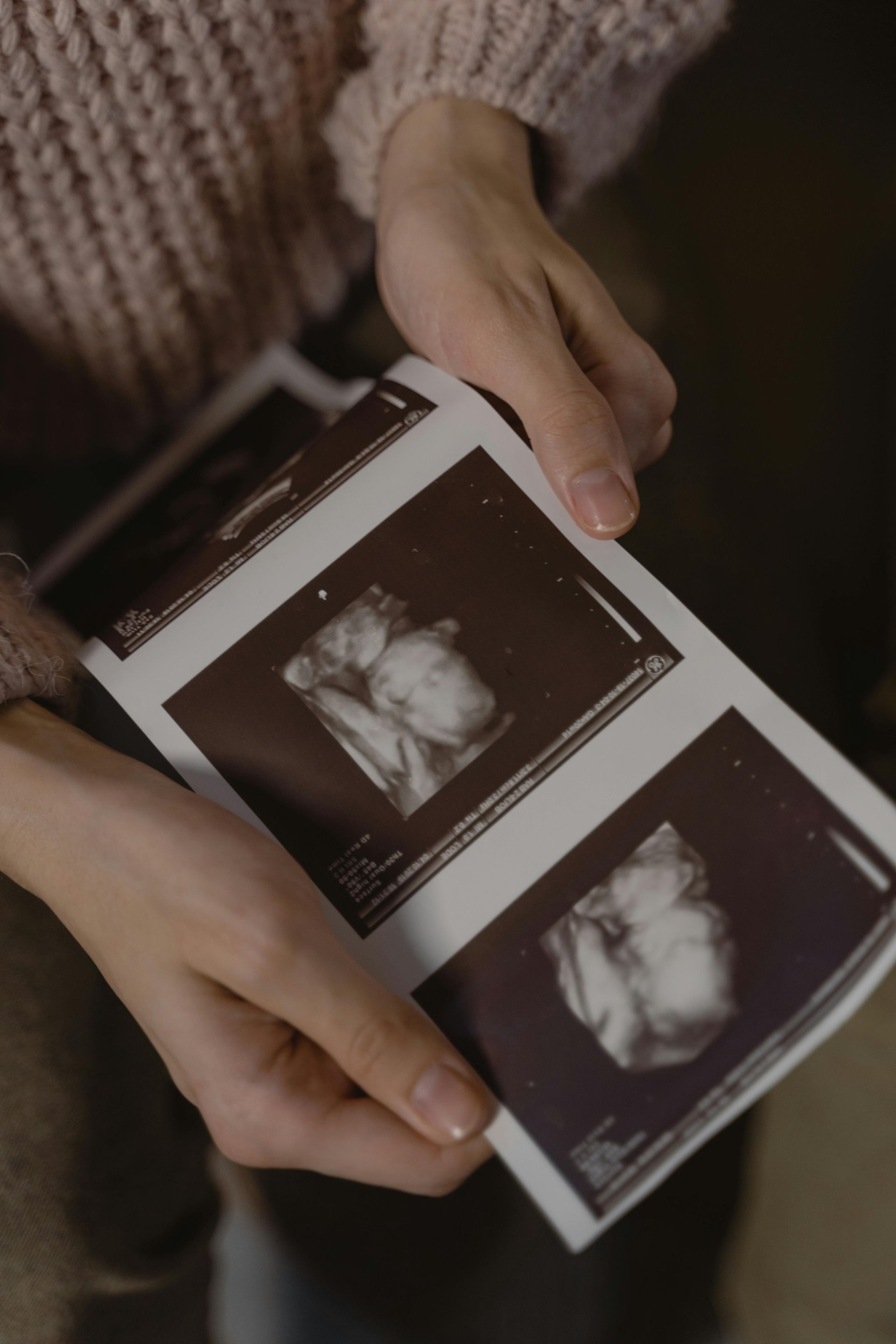 Person holding sonogram photos.
