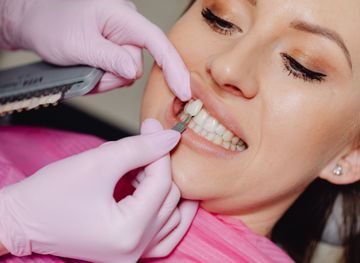 Dentist matching shade of a veneer to a patient's teeth in a dental office; hands in pink gloves.