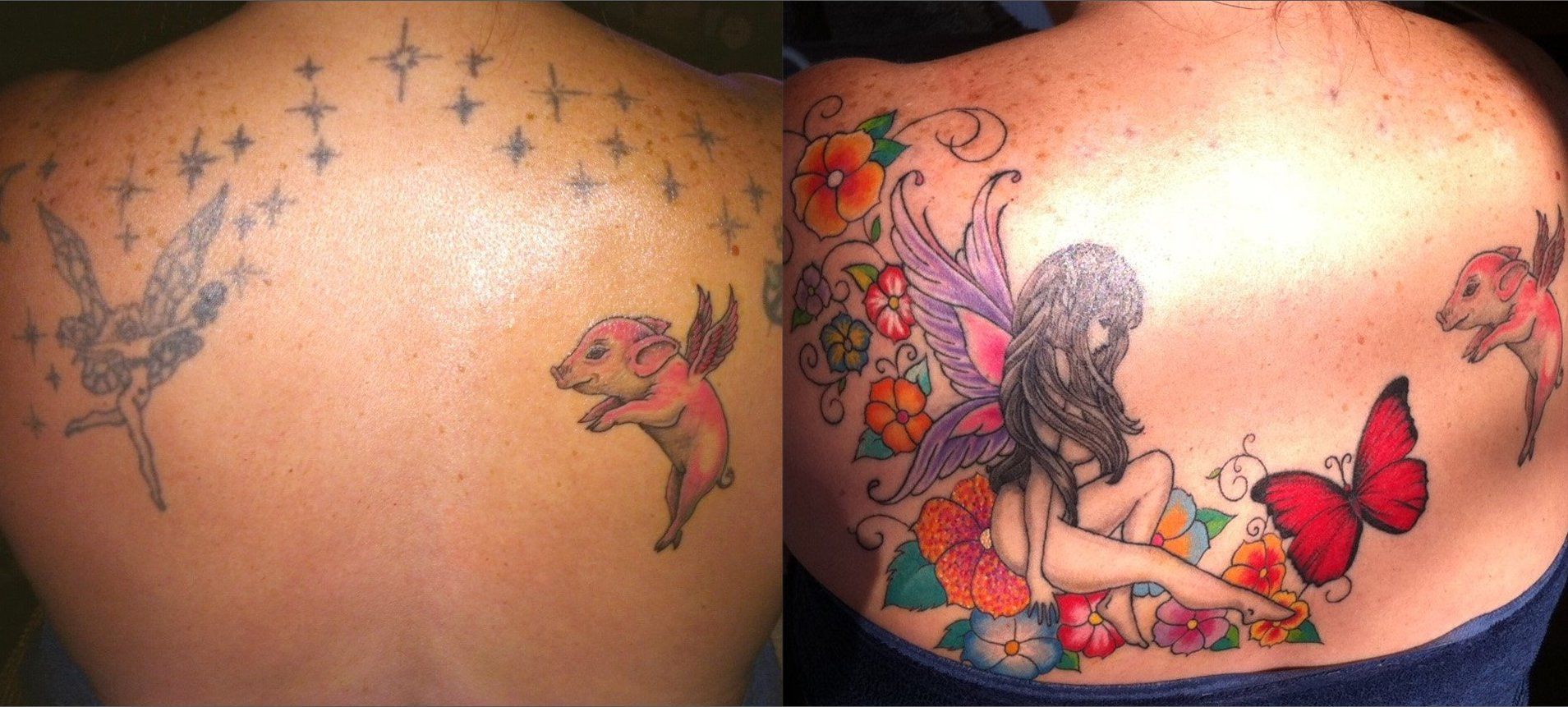 Remarkable tattoo removal results from Premier Beauty Medical Aesthetics in Redlands. Before: large detailed shoulder tattoo. After: completely clear skin with no visible ink. Advanced PicoSure laser technology delivering superior results for tattoo removal in the Inland Empire.