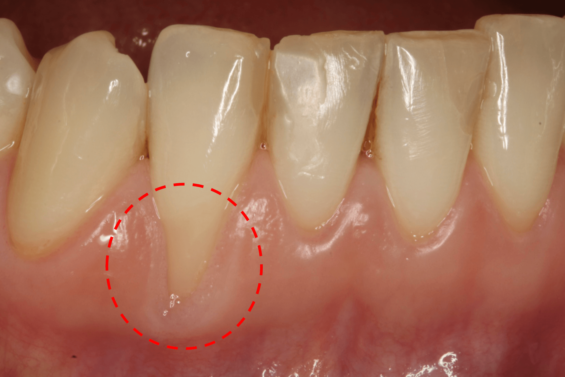 dentista controlla denti bambino