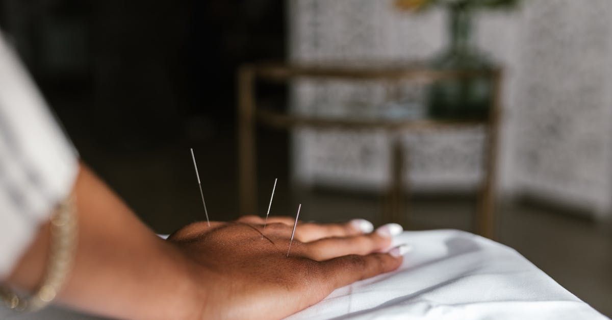 acupuncture