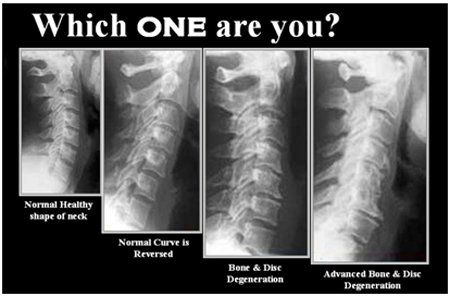 X-Rays — Penrith, NSW — Penrith Chiropractic Centre