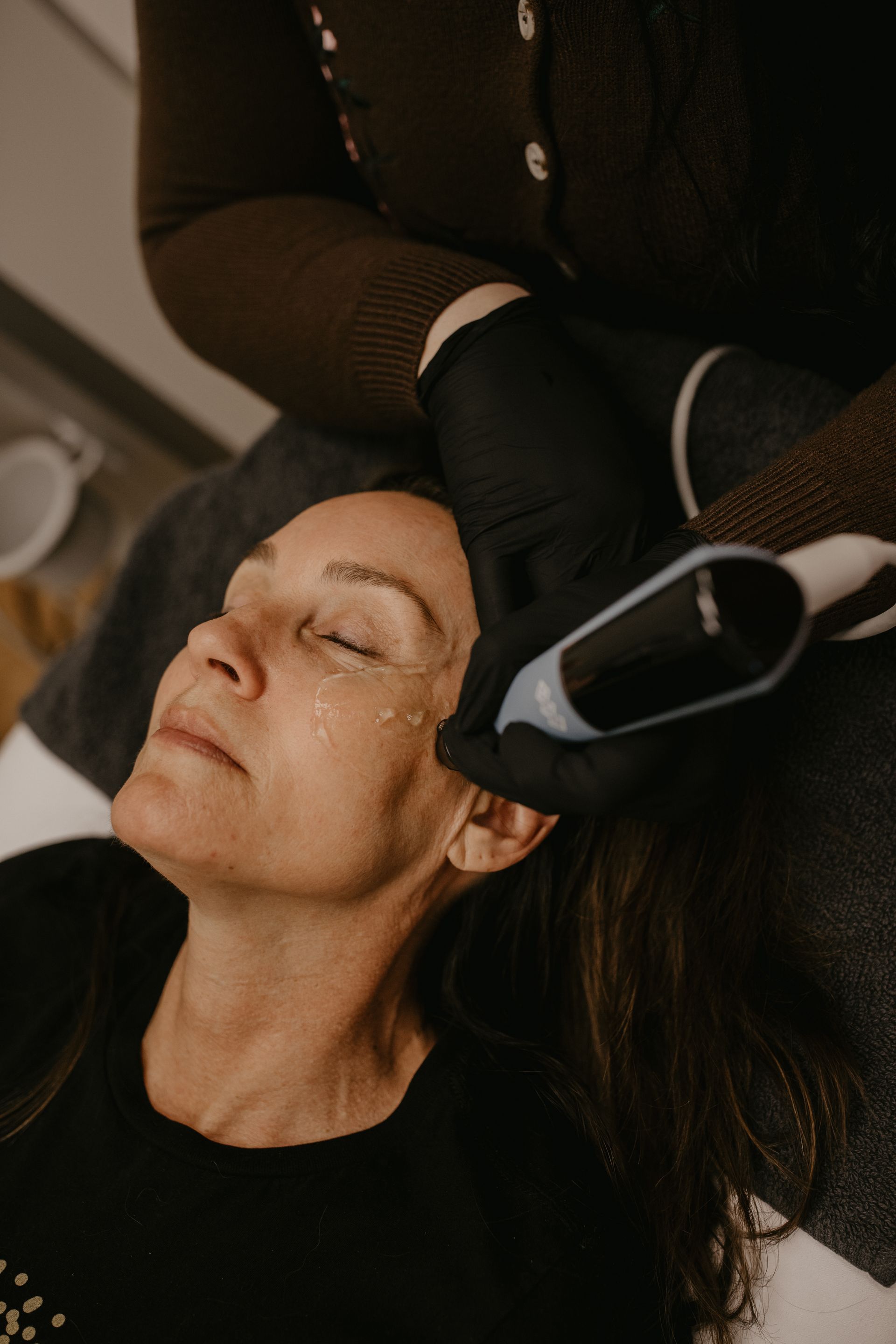 Person receiving facial treatment. Technician's gloved hand holds device near woman's face. Close up.
