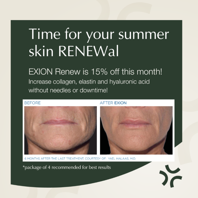 A poster that says time for your summer skin renewal