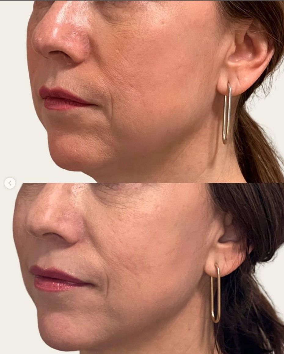 A before and after photo of a woman 's face with earrings.