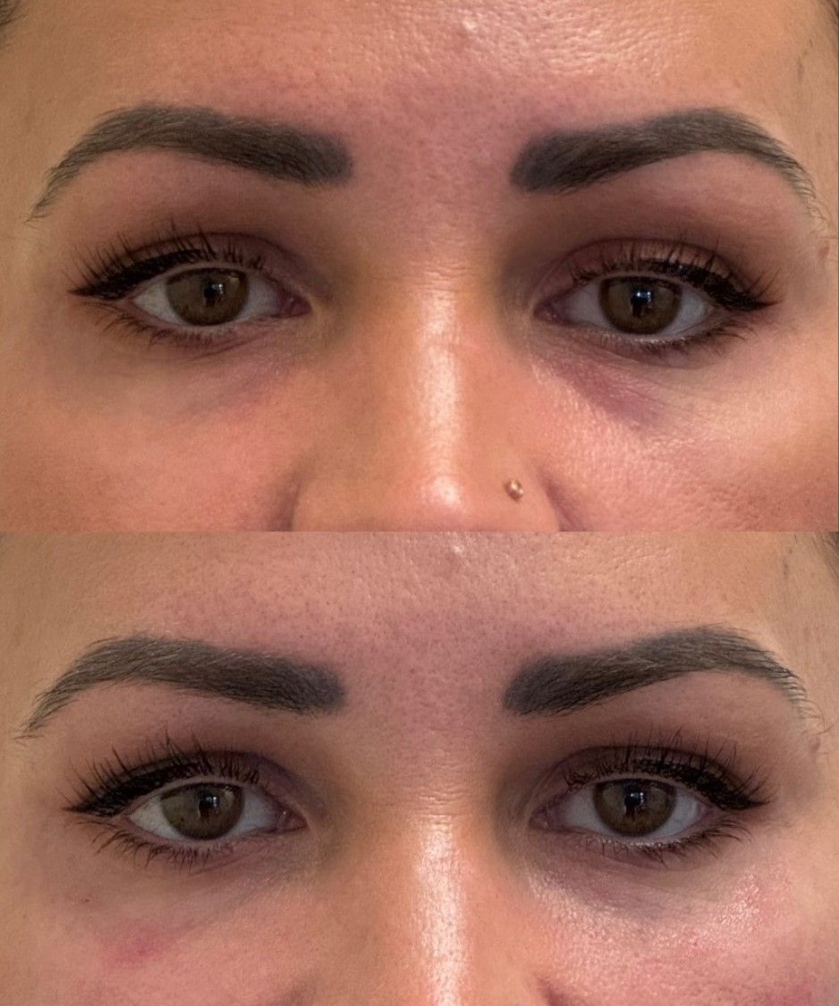 A before and after photo of a woman 's eyes.