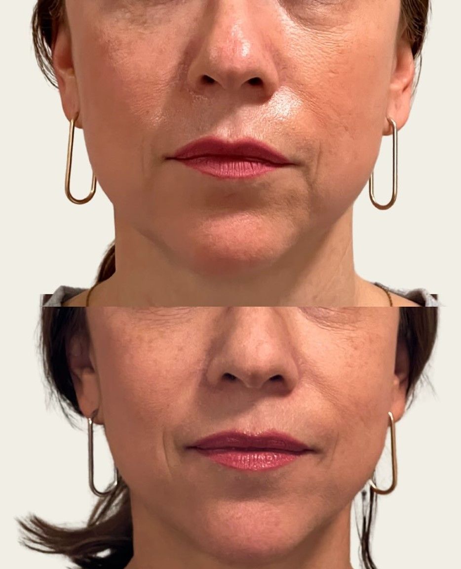 A woman 's face is shown before and after wearing earrings