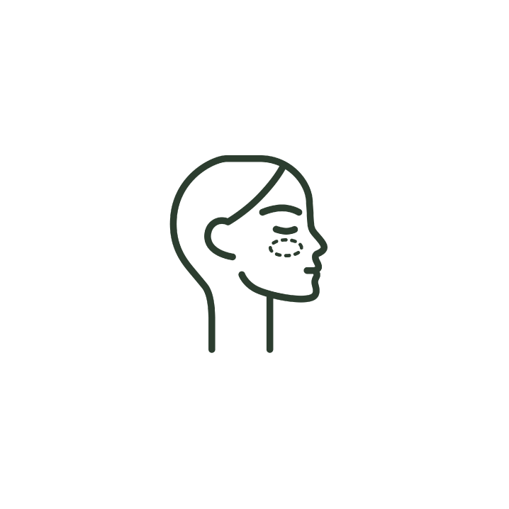 Line art profile of a human head with a dashed oval highlighting the cheek area.