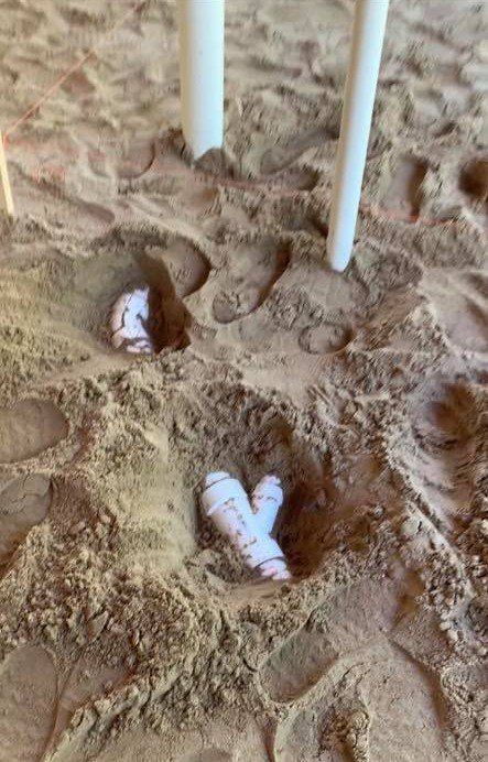 A couple of eggs are laying in a hole in the sand.