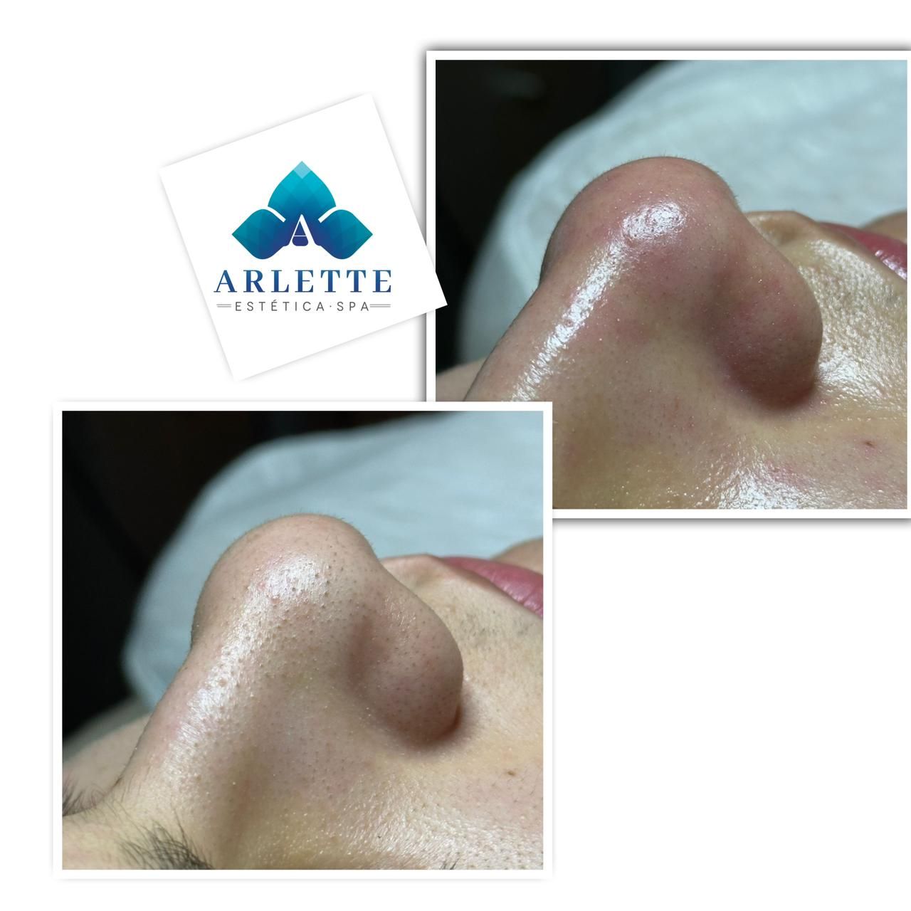 ARLETTE ESTÉTICA & SPA