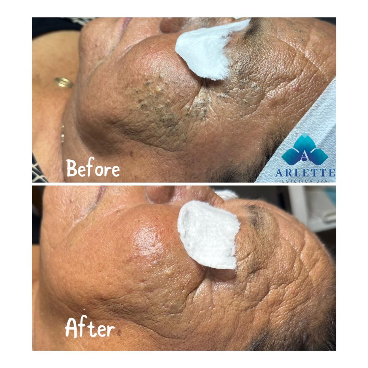 ARLETTE ESTÉTICA & SPA