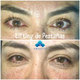 ARLETTE ESTÉTICA & SPA 