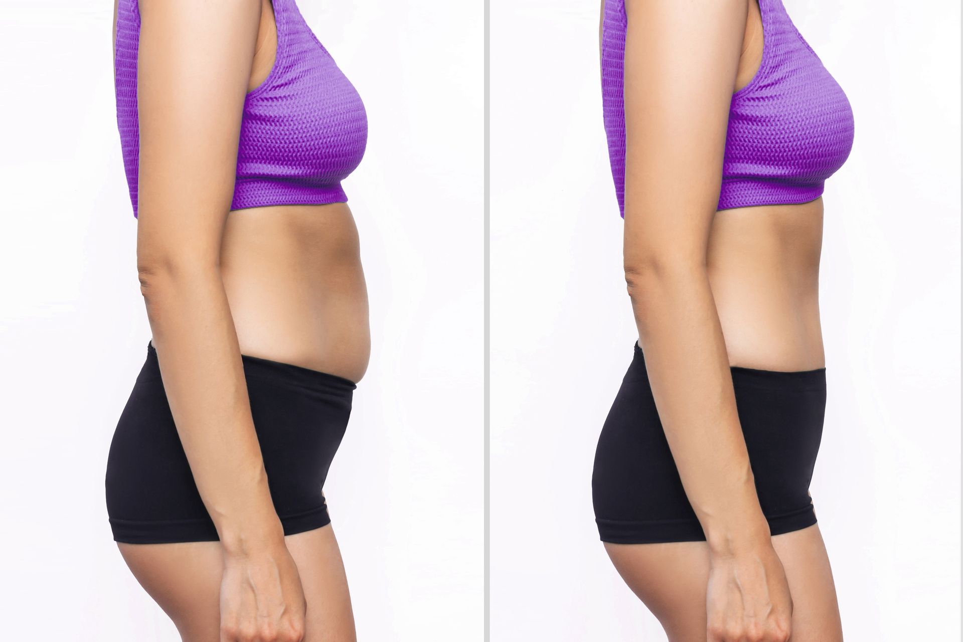Comparison of young woman's belly with excess fat and toned slim stomach before after