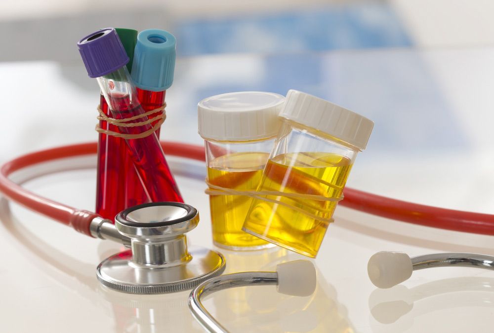 A Stethoscope, Test Tubes, and a Bottle of Urine Are on a Table — Mount Archer Medical Centre in Berserker, QLD