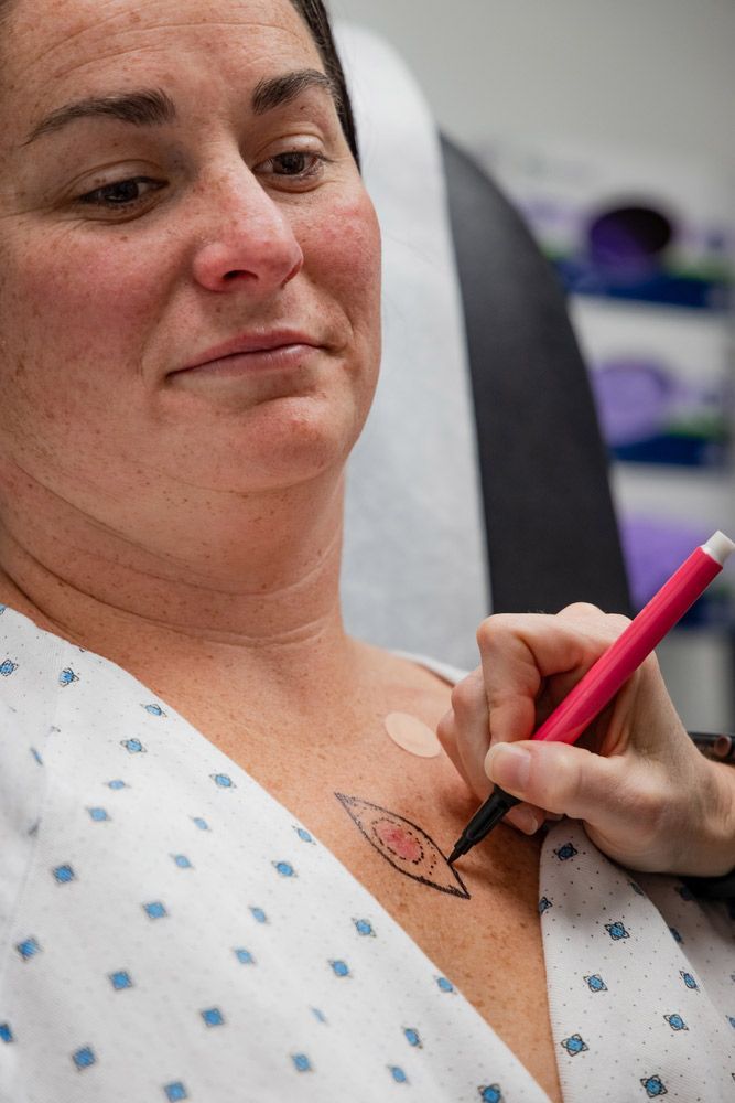 A Woman in a Hospital Gown is Getting a Tattoo on Her Chest — Mount Archer Medical Centre in Berserker, QLD