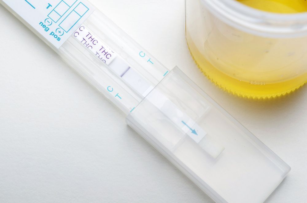 A Urine Test is Sitting Next to a Cup of Urine — Mount Archer Medical Centre in Berserker, QLD