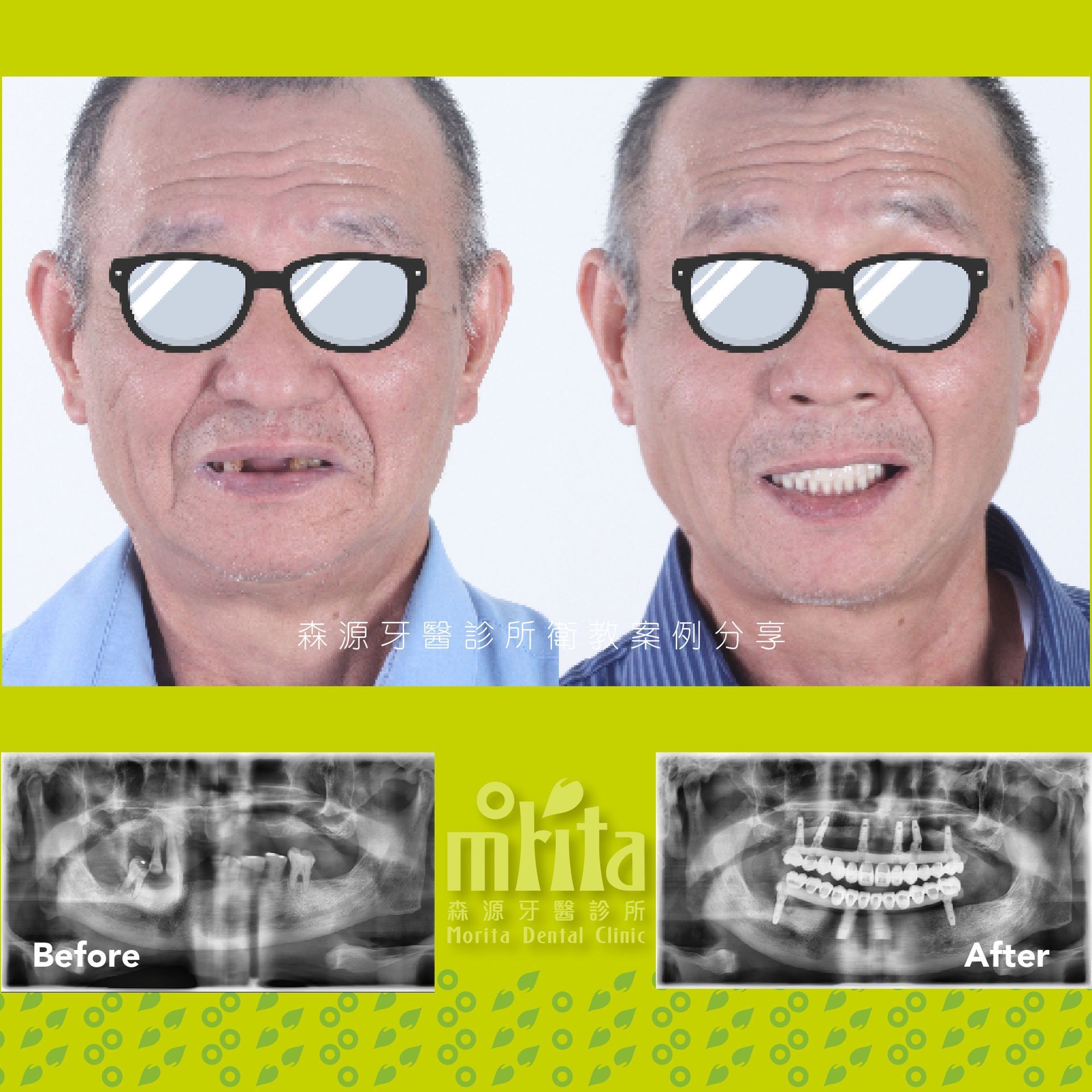 A before and after photo of a man wearing glasses