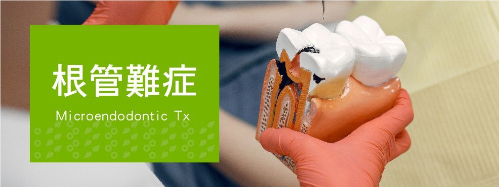 根管難症