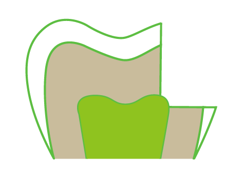 A drawing of a tooth with a green tooth in the middle.