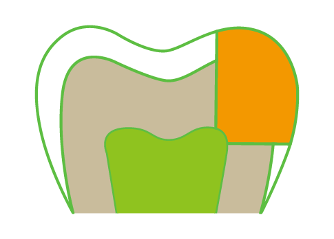 A cartoon drawing of a tooth with a green tooth and an orange tooth.