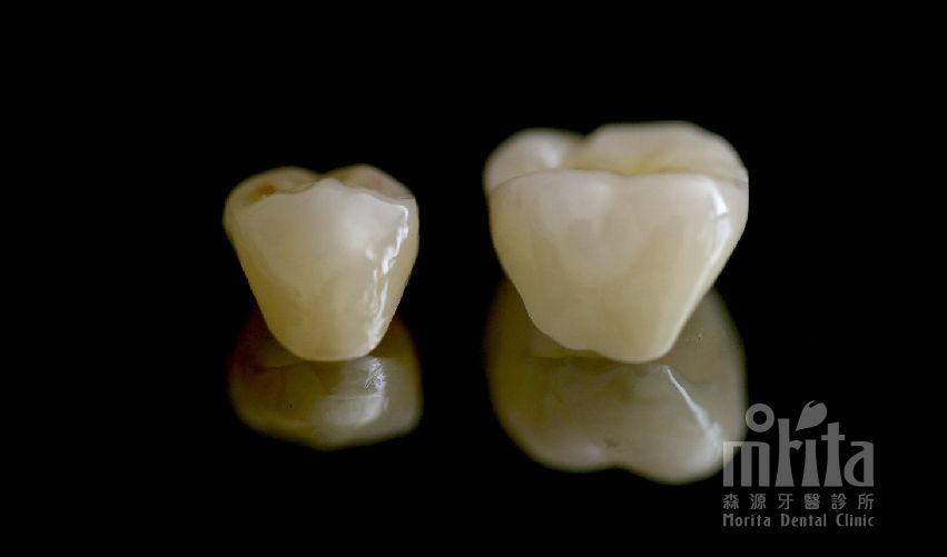Two dental crowns on a black background with the word mhita on the bottom