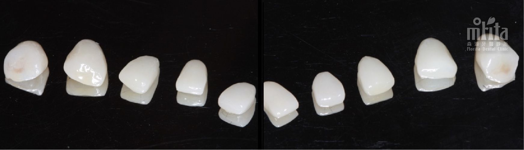 A row of white teeth on a black background